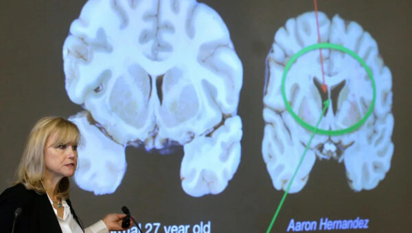 One in four NFL players could get CTE, alarming new study finds