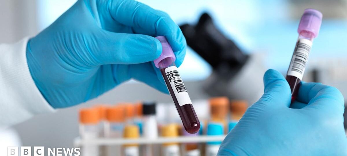 England set to eliminate hepatitis C