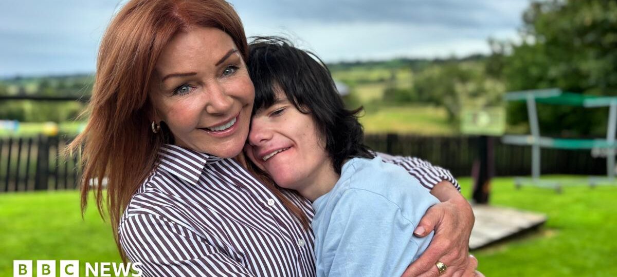Boy who changed law on medicinal cannabis thriving as he turns 21