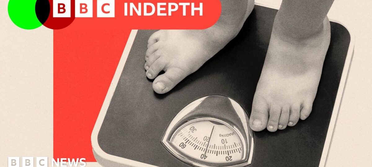 The overlooked factor driving the childhood obesity crisis