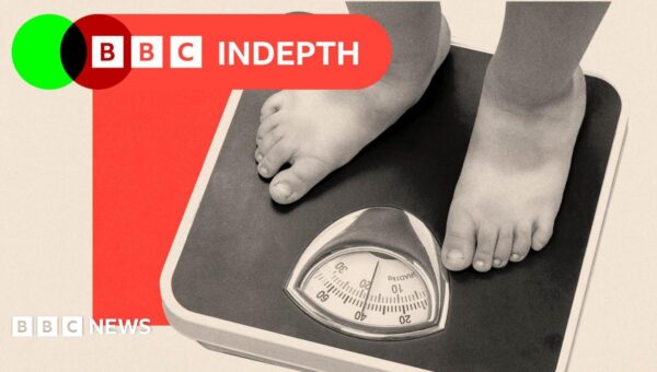 The overlooked factor driving the childhood obesity crisis