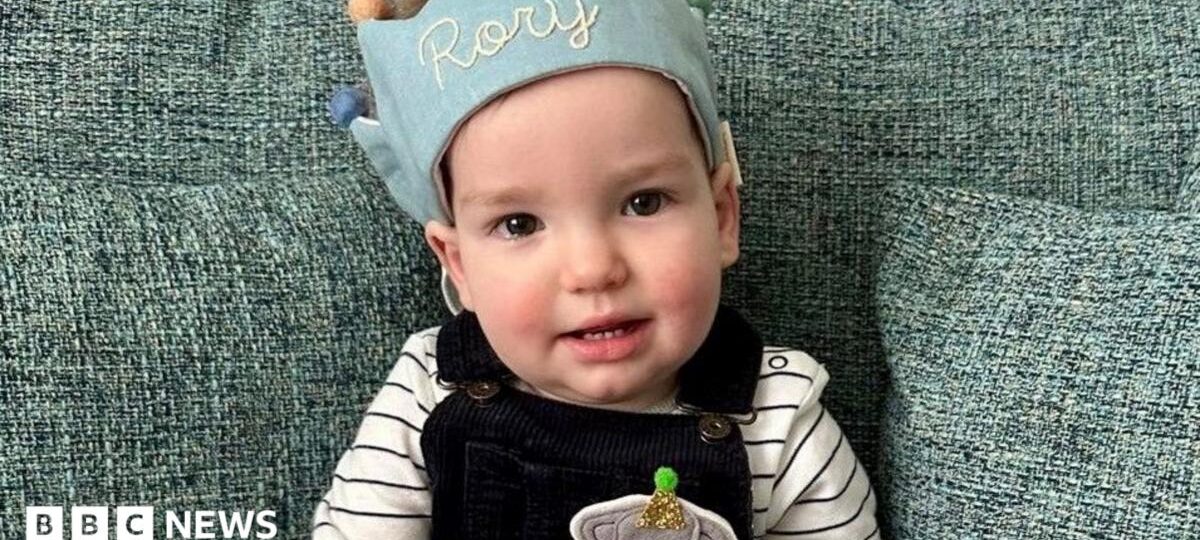 World-first surgery for baby's rare skull condition