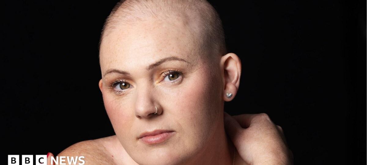 Chemo hair loss doesn't define me - it's a symbol that I'm strong