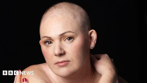 Chemo hair loss doesn’t define me – it’s a symbol that I’m strong