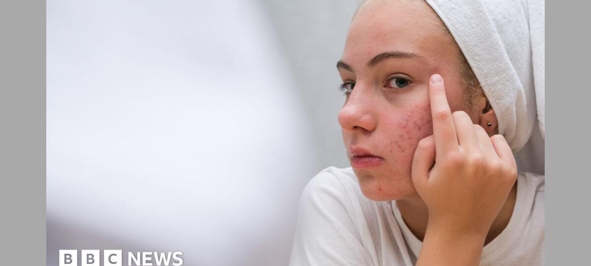 The simple skincare routine for teens that actually works - and five expert tips