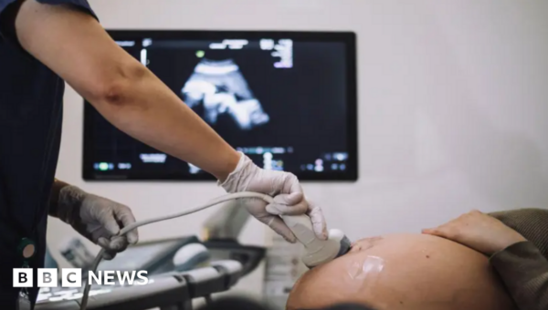 NHS trust admits ‘failing families’ over stillbirths