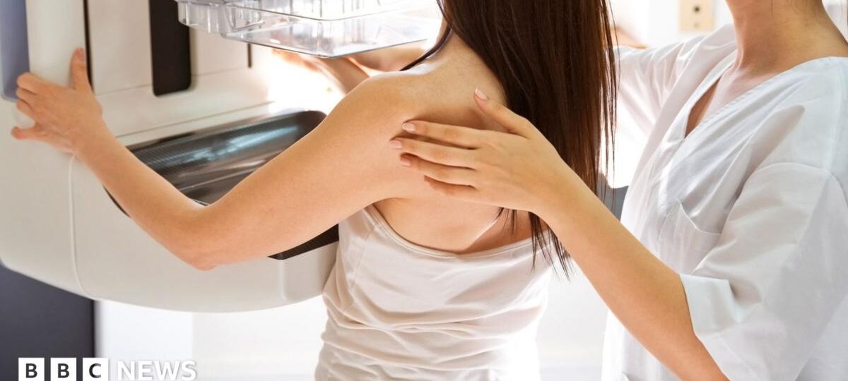 NHS trust to reexamine 4,500 breast cancer cases after unnecessary surgeries found