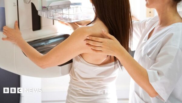 NHS trust to reexamine 4,500 breast cancer cases after unnecessary surgeries found