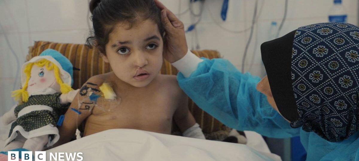 Girl has multiple surgeries to control infections after strike in Gaza