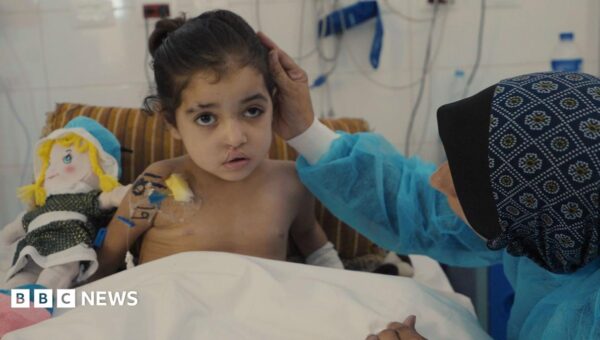 Girl has multiple surgeries to control infections after strike in Gaza