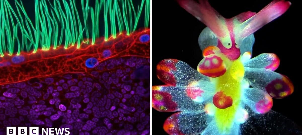 See tiny organisms on show in microscopic video competition