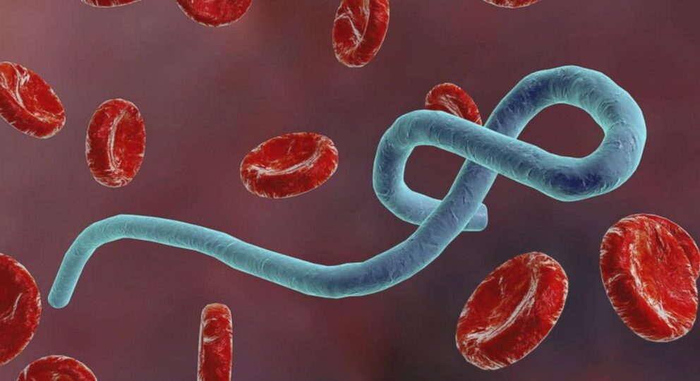 Breaking: Two suspected Ebola cases identified in North-East Nigeria – NCDC