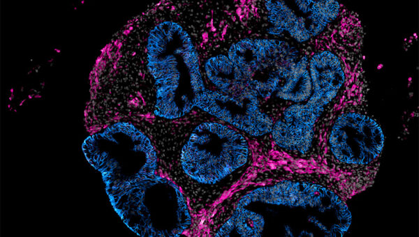 Intero Biosystems wants drugmakers to test on mini human intestines, not animals