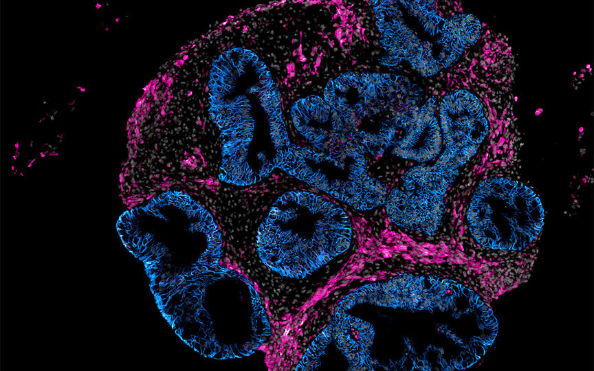 Intero Biosystems wants drugmakers to test on mini human intestines, not animals