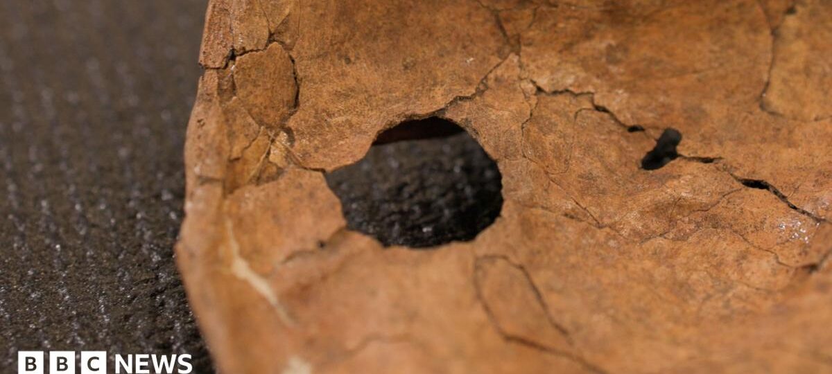 Was Neanderthal life violent? This wound suggests lethal fighting was more common