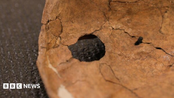 Was Neanderthal life violent? This wound suggests lethal fighting was more common