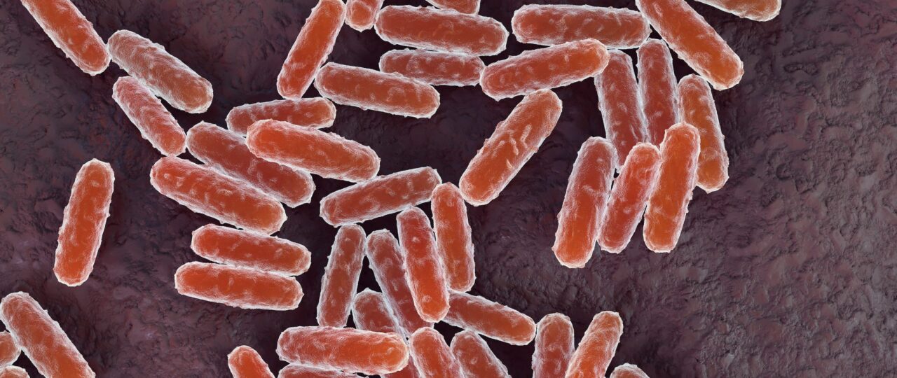 Is Pneumonic Plague in America? What to Know as the Infection Spreads in Russia