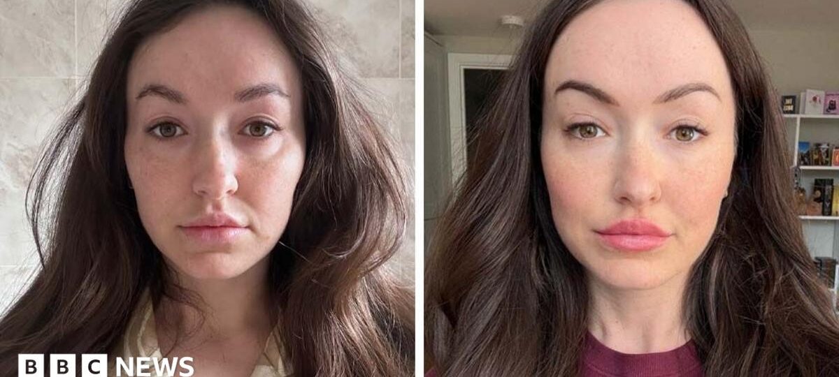 Is 'ferritin face' a real thing - and can you really spot low iron from looks?