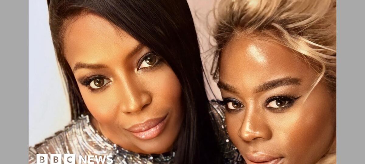 I lost my hair to MS treatment - now my wigs are worn by Naomi Campbell and Serena Williams