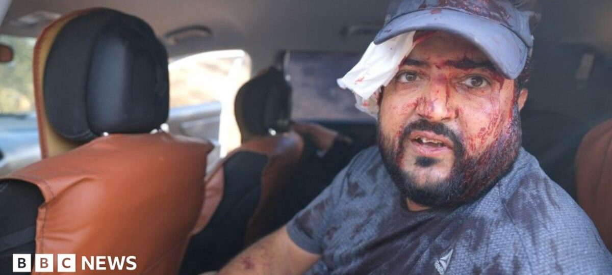 Palestinians and US journalist injured by Israeli settlers in West Bank harvest attack
