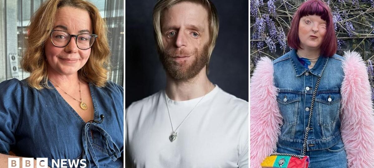 'Super offensive' - We love how we look but AI tried to 'fix' our visible differences