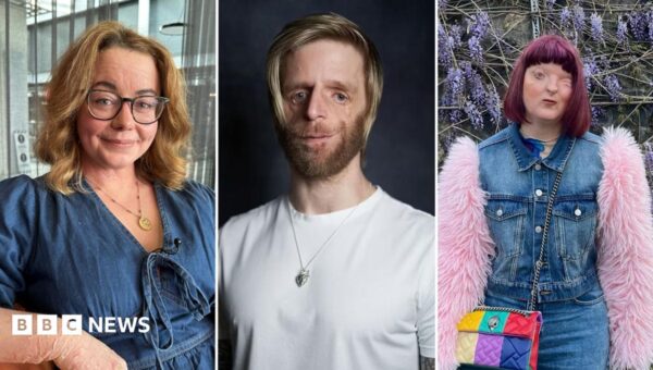 ‘Super offensive’ – We love how we look but AI tried to ‘fix’ our visible differences
