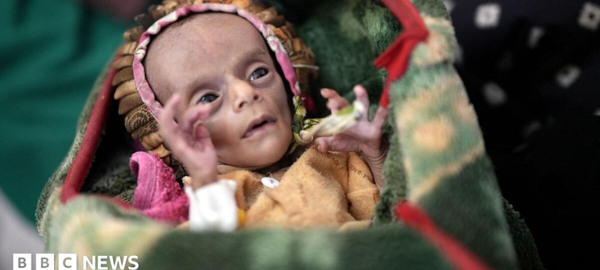 Newborn twins fight for survival as conflict fuels Yemen's hunger crisis